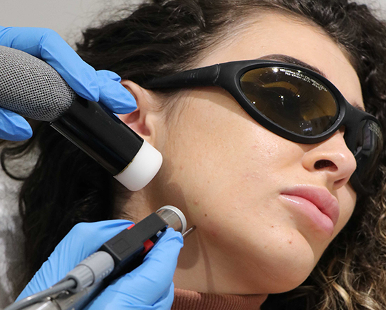 hair-removal_side_img