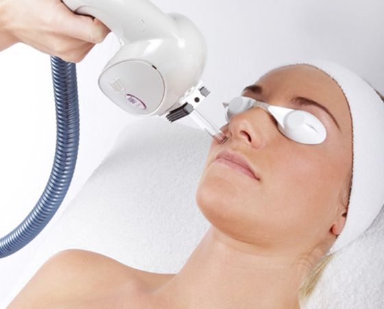 IPL-Rosacea_side_img-1