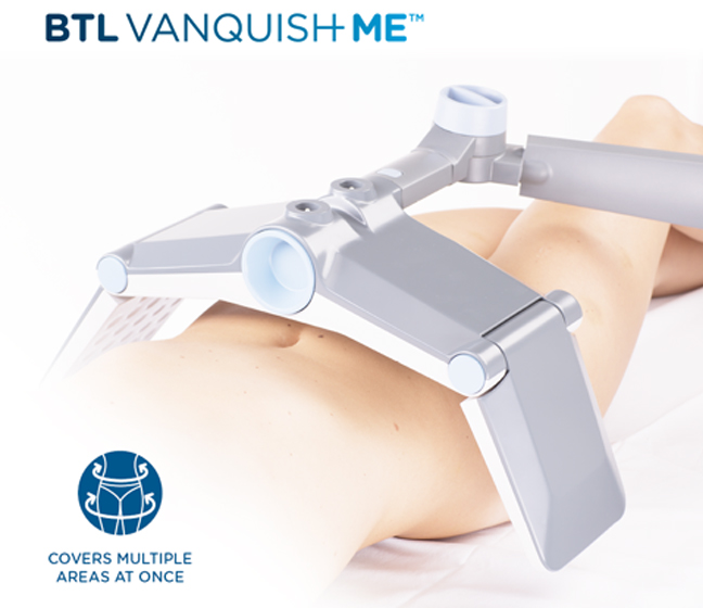 Vanquish-Me-featured-img-1