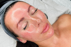 glow facial