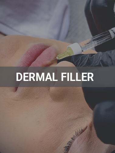 Dermal Filler